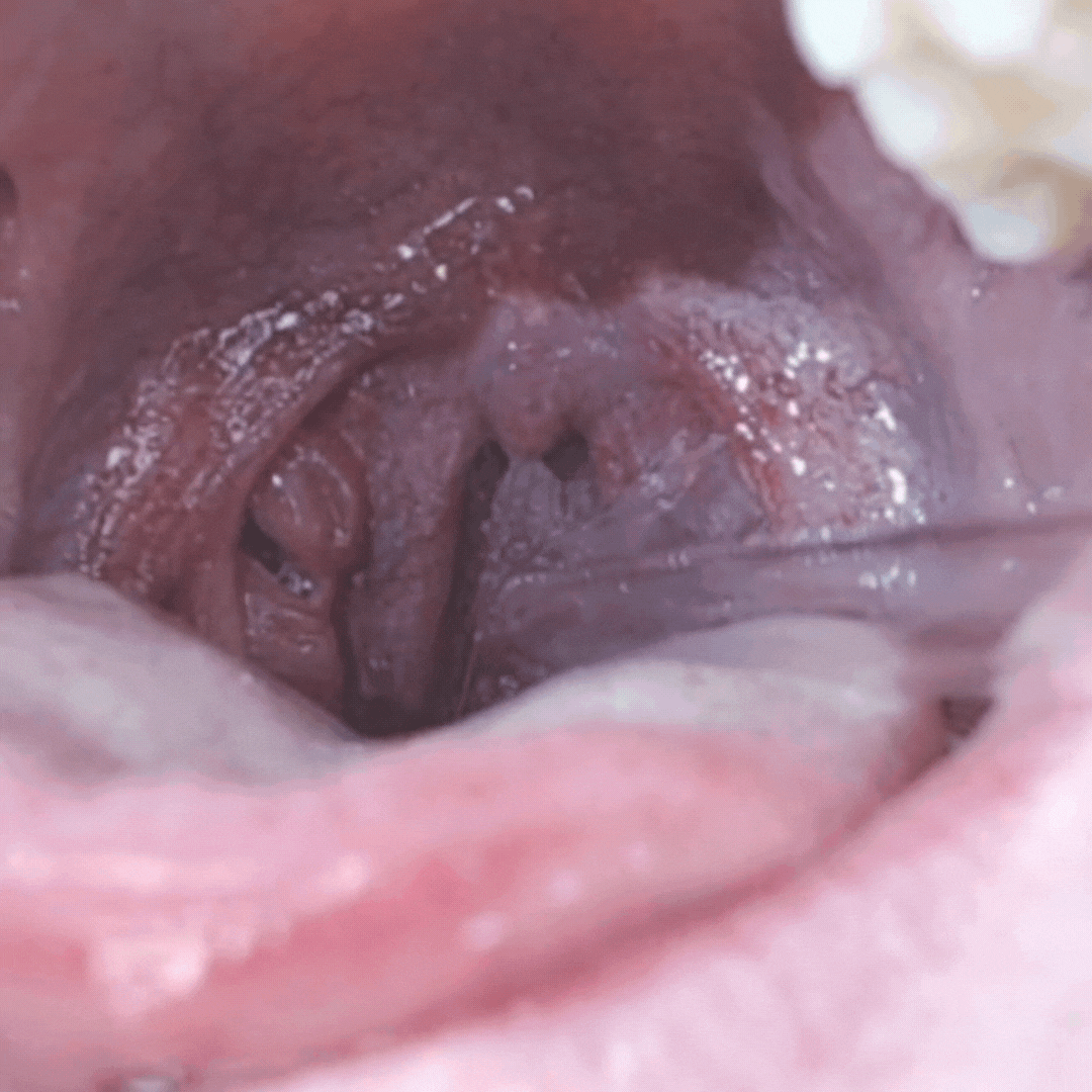 Oralclean - ein Leben ohne Mundgeruch
