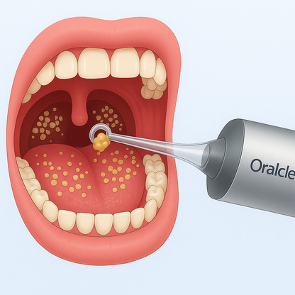 Oralclean