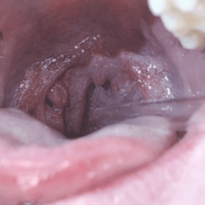 Oralclean - ein Leben ohne Mundgeruch